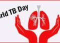 Early Detection and Accurate Diagnosis crucial to make India TB Free by 2025 – HaystackAnalytics Insights